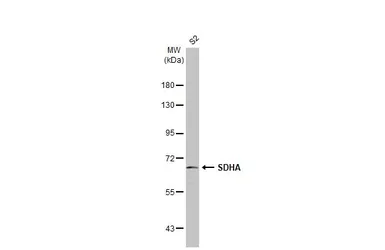 Anti-SDHA antibody [HL1117] used in Western Blot (WB). GTX636335