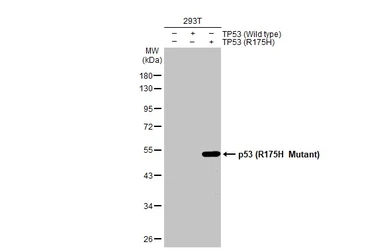 Anti-p53 (R175H Mutant) antibody [HL1129] used in Western Blot (WB). GTX636395