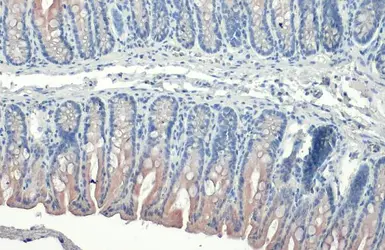 Anti-Cytokeratin 19 antibody [HL1165] used in IHC (Paraffin sections) (IHC-P). GTX636469