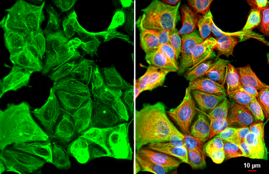 Anti-Cytokeratin 19 antibody [HL1165] used in Immunocytochemistry/ Immunofluorescence (ICC/IF). GTX636469