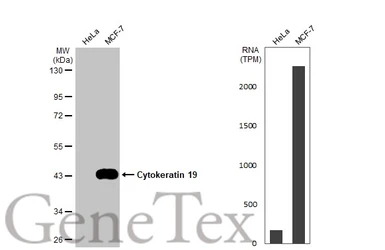 Anti-Cytokeratin 19 antibody [HL1165] used in Western Blot (WB). GTX636469