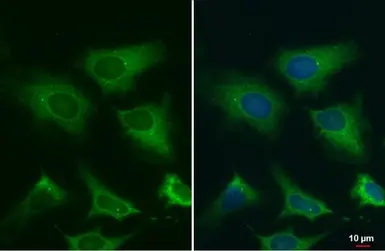 Anti-gamma Tubulin antibody [HL1175] used in Immunocytochemistry/ Immunofluorescence (ICC/IF). GTX636480