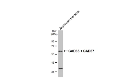 Anti-GAD65 + GAD67 antibody [HL1181] used in Western Blot (WB). GTX636487