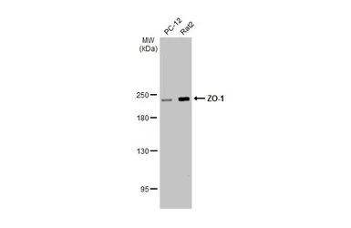 Anti-ZO-1 antibody [HL1185] used in Western Blot (WB). GTX636491