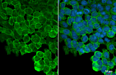 Anti-ZO-1 antibody [HL1185] used in Immunocytochemistry/ Immunofluorescence (ICC/IF). GTX636491