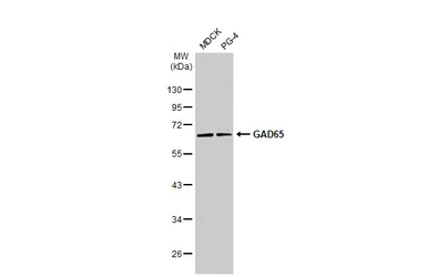 Anti-GAD65 antibody [HL1187] used in Western Blot (WB). GTX636493