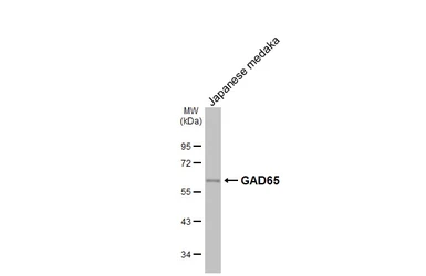 Anti-GAD65 antibody [HL1187] used in Western Blot (WB). GTX636493