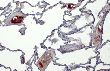 Anti-C1 inhibitor antibody [HL1197] used in IHC (Paraffin sections) (IHC-P). GTX636509