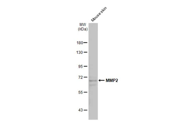 Anti-MMP2 antibody [HL1208] used in Western Blot (WB). GTX636525
