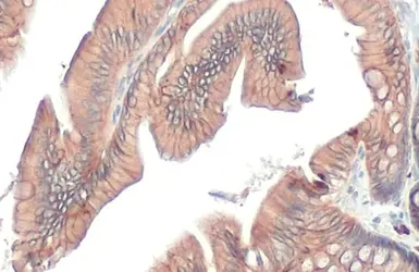 Anti-E-Cadherin antibody [HL1228] used in IHC (Paraffin sections) (IHC-P). GTX636576