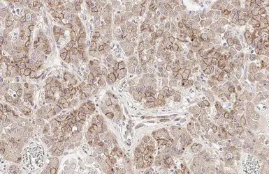 Anti-E-Cadherin antibody [HL1228] used in IHC (Paraffin sections) (IHC-P). GTX636576