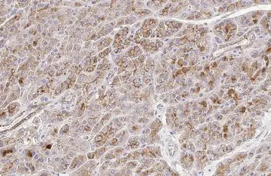 Anti-E-Cadherin antibody [HL1228] used in IHC (Paraffin sections) (IHC-P). GTX636576