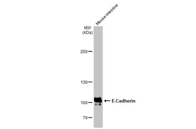 Anti-E-Cadherin antibody [HL1228] used in Western Blot (WB). GTX636576
