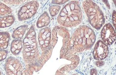 Anti-E-Cadherin antibody [HL1229] used in IHC (Paraffin sections) (IHC-P). GTX636577