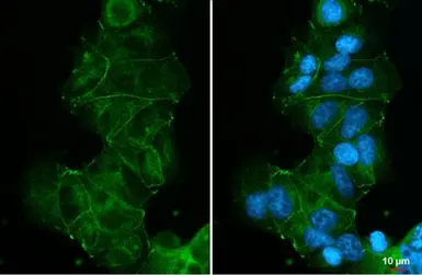 Anti-E-Cadherin antibody [HL1229] used in Immunocytochemistry/ Immunofluorescence (ICC/IF). GTX636577