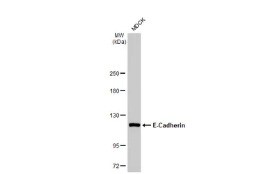 Anti-E-Cadherin antibody [HL1229] used in Western Blot (WB). GTX636577