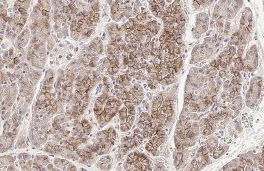 Anti-E-Cadherin antibody [HL1229] used in IHC (Paraffin sections) (IHC-P). GTX636577