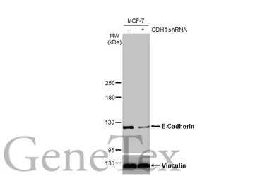 Anti-E-Cadherin antibody [HL1229] used in Western Blot (WB). GTX636577