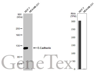 Anti-E-Cadherin antibody [HL1229] used in Western Blot (WB). GTX636577