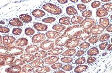Anti-E-Cadherin antibody [HL1229] used in IHC (Paraffin sections) (IHC-P). GTX636577