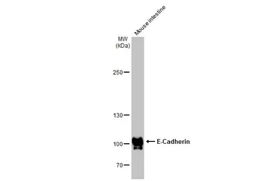 Anti-E-Cadherin antibody [HL1229] used in Western Blot (WB). GTX636577