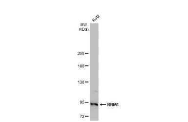 Anti-RRM1 antibody [HL1230] used in Western Blot (WB). GTX636578