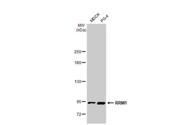 Anti-RRM1 antibody [HL1230] used in Western Blot (WB). GTX636578