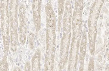 Anti-RRM1 antibody [HL1230] used in IHC (Paraffin sections) (IHC-P). GTX636578