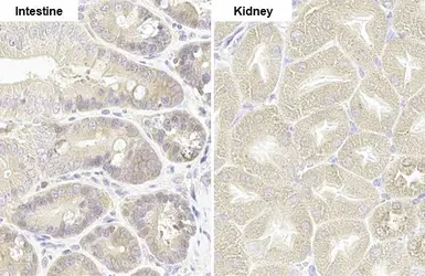 Anti-RRM1 antibody [HL1230] used in IHC (Paraffin sections) (IHC-P). GTX636578