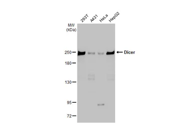 Anti-Dicer antibody [HL1232] used in Western Blot (WB). GTX636580