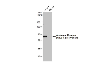 Anti-Androgen Receptor (ARv7 Splice Variant) antibody [HL1239] used in Western Blot (WB). GTX636638