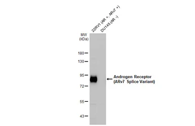 Anti-Androgen Receptor (ARv7 Splice Variant) antibody [HL1240] used in Western Blot (WB). GTX636639