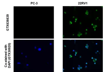 Anti-Androgen Receptor (ARv7 Splice Variant) antibody [HL1240] used in IHC-P (cell pellet) (IHC-P (cell pellet)). GTX636639