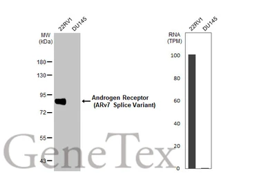 Anti-Androgen Receptor (ARv7 Splice Variant) antibody [HL1240] used in Western Blot (WB). GTX636639