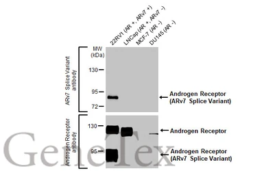 Anti-Androgen Receptor (ARv7 Splice Variant) antibody [HL1240] used in Western Blot (WB). GTX636639
