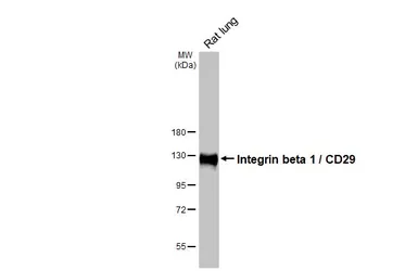 Anti-Integrin beta 1 / CD29 antibody [HL1255] used in Western Blot (WB). GTX636657