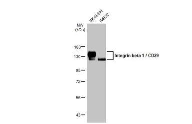 Anti-Integrin beta 1 / CD29 antibody [HL1256] used in Western Blot (WB). GTX636658
