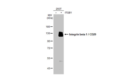 Anti-Integrin beta 1 / CD29 antibody [HL1256] used in Western Blot (WB). GTX636658