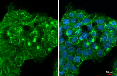 Anti-Integrin beta 1 / CD29 antibody [HL1256] used in Immunocytochemistry/ Immunofluorescence (ICC/IF). GTX636658