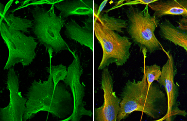 Anti-MMP1 antibody [HL1259] used in Immunocytochemistry/ Immunofluorescence (ICC/IF). GTX636661