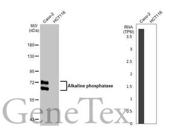 Anti-Alkaline phosphatase antibody [HL1267] used in Western Blot (WB). GTX636669
