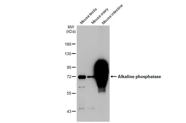 Anti-Alkaline phosphatase antibody [HL1267] used in Western Blot (WB). GTX636669