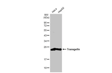Anti-Transgelin antibody [HL1270] used in Western Blot (WB). GTX636672