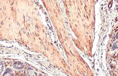 Anti-Transgelin antibody [HL1270] used in IHC (Paraffin sections) (IHC-P). GTX636672
