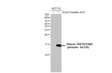 Anti-Histone H2A.XS139ph (phospho Ser139) antibody [HL1299] used in Western Blot (WB). GTX636713