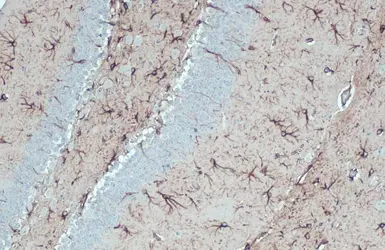 Anti-GFAP antibody [HL1307] used in IHC (Paraffin sections) (IHC-P). GTX636725