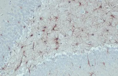 Anti-GFAP antibody [HL1307] used in IHC (Paraffin sections) (IHC-P). GTX636725