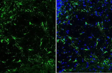 Anti-GFAP antibody [HL1307] used in IHC (Frozen sections) (IHC-Fr). GTX636725