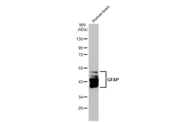 Anti-GFAP antibody [HL1307] used in Western Blot (WB). GTX636725