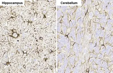 Anti-GFAP antibody [HL1307] used in IHC (Paraffin sections) (IHC-P). GTX636725